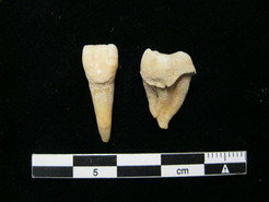 Bronze Age human teeth with dental calculus deposits from Mongolia.