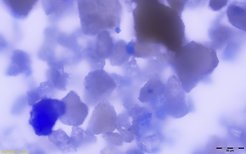 Vergrößerte Ansicht der Lapislazuli-Partikel im Zahnstein einer mittelalterlichen Frau.