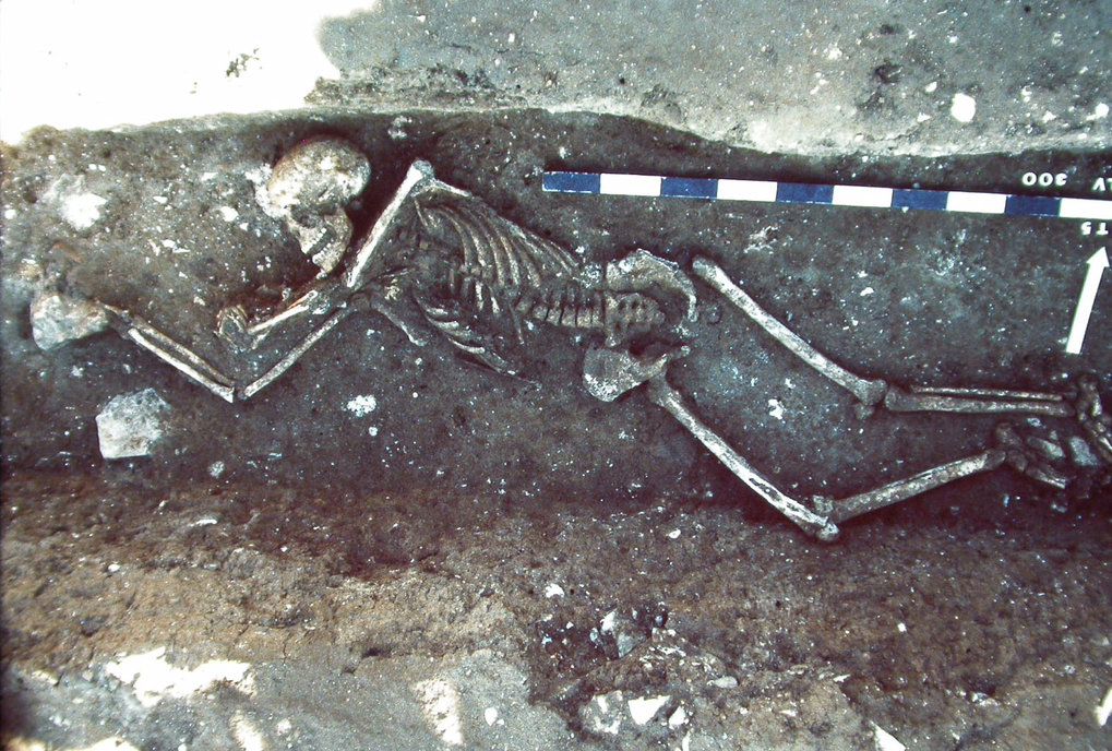 Lunel-Viel (Languedoc-Southern France). Victim of the plague thrown into a demolition trench of a Gallo-Roman house; end of the 6th-early 7th century.