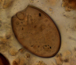 Die Eier parasitärer Würmer unter dem Mikroskop