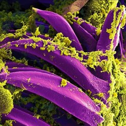 Scanning electron micrograph of Y. pestis