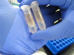 Extraction of ancient DNA from human dental calculus. Extracted protein can be observed as a white residue.