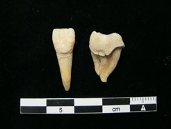 Bronze Age human teeth with dental calculus deposits from Mongolia.